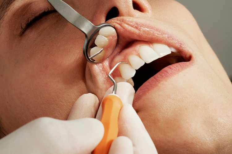 Irvine Dentist