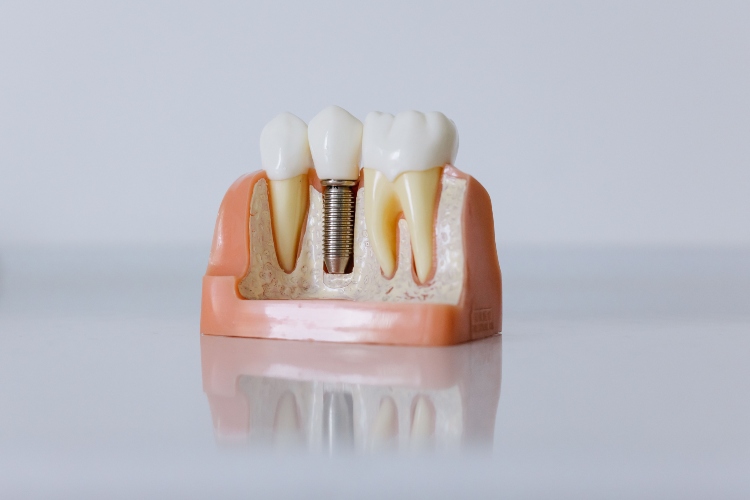 Irvine Dentist